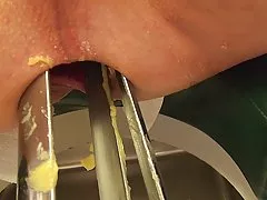 Enorma spekulum rumpa, dubbel fisting, pump